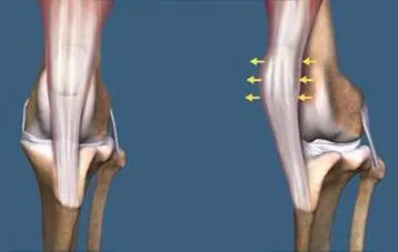 Diagrammatic representation of medial patellar luxation