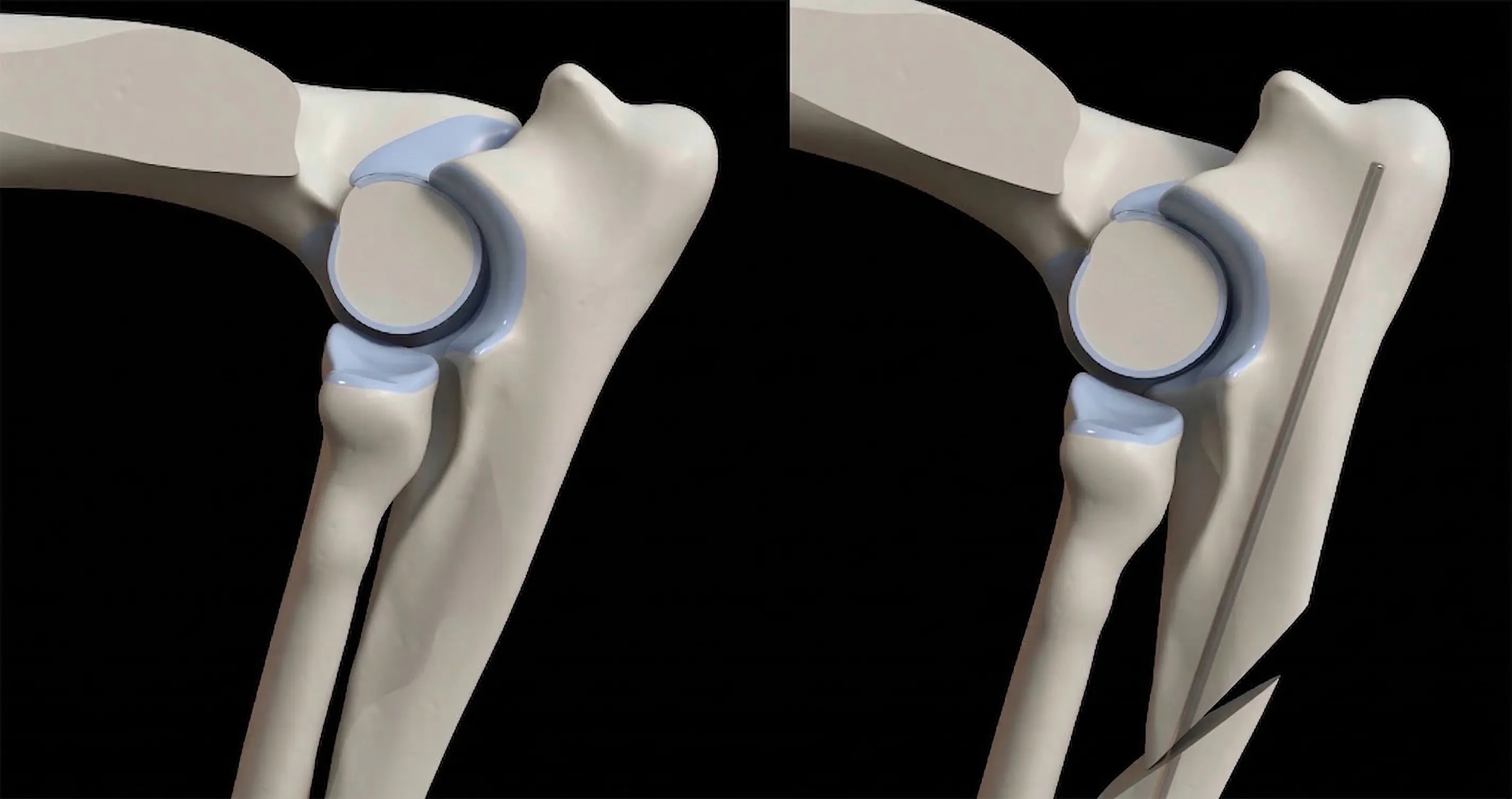 Radiograph of BODPUO