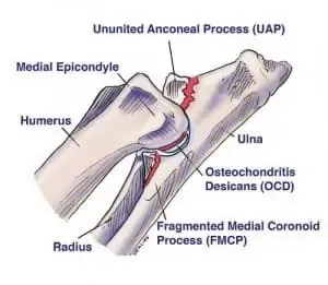 Diagram showing radioulnar incongruence and elbow joint conflict
