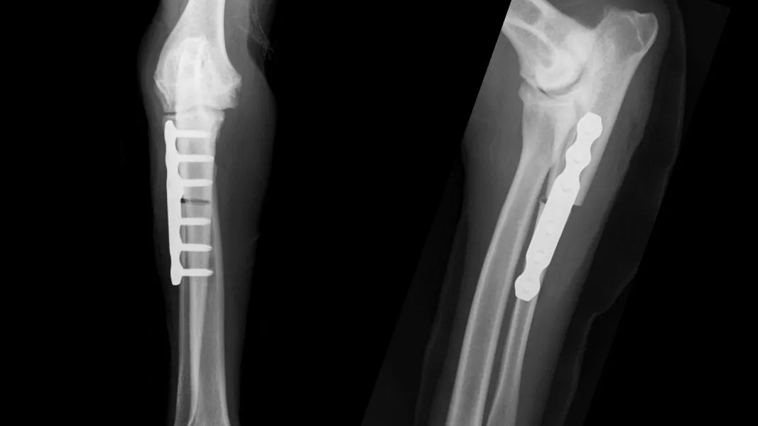 Radiograph of PAUL plate